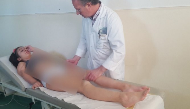 OTRĂVITĂ CU ACID, ARSĂ CU ȚIGARA DE NENUMĂRATE ORI / DRAMA UNEI COPILE, OPERATE PENTRU A 44-A OARĂ - kassandrarotariulaoperatie667x50-1497938292.jpg
