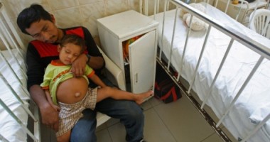 Foto : INCREDIBIL/ Un b�ie�el de trei ani �i poart� geam�nul nen�scut �n burt� (FOTO �i VIDEO)