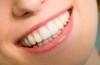 dental-1337379970.jpg : Presiunea atmosferic� d� dureri de din�i