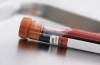 tratamentpreventivpentruhiv-1369050738.jpg : MS acord� suficiente fonduri pentru tratamentele pentru HIV