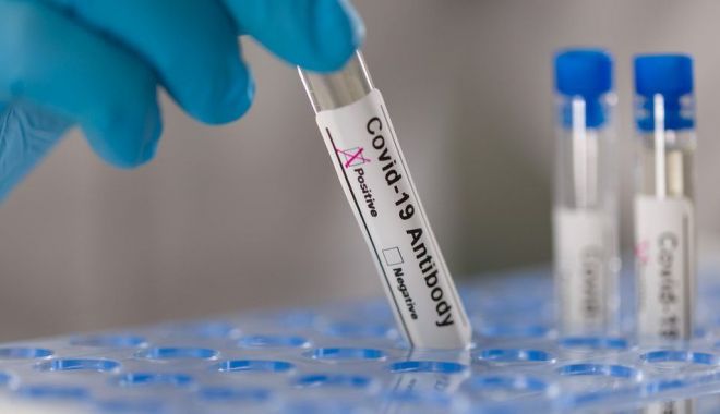 COVID-19. Din ce în ce mai puţine cazuri înregistrate, la Constanţa