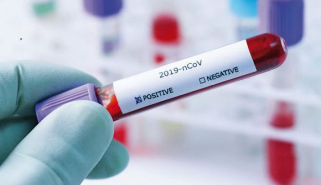 Coronavirus în România. Peste 5.000 de cazuri noi, în ultimele 24 de ore