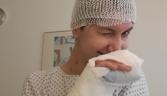 A fost inventat primul aparat care produce piele pentru transplanturi