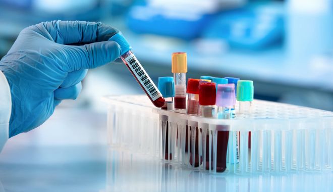 Persoanele care infectează pe cineva cu Covid-19 ar putea fi acuzate de omucidere în Filipine