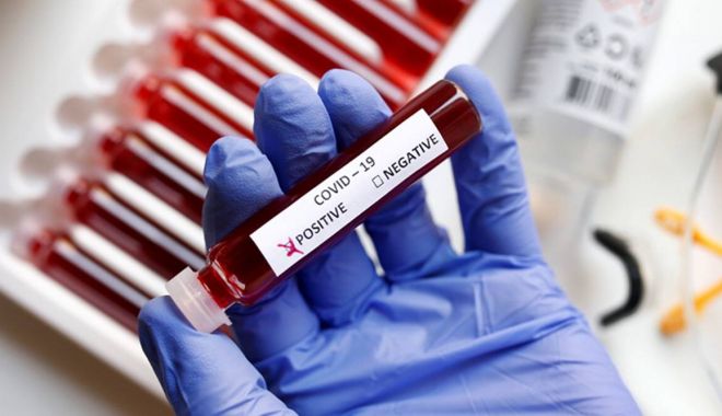 Coronavirus la Constanţa. Câte persoane au fost infectate cu COVID până în prezent