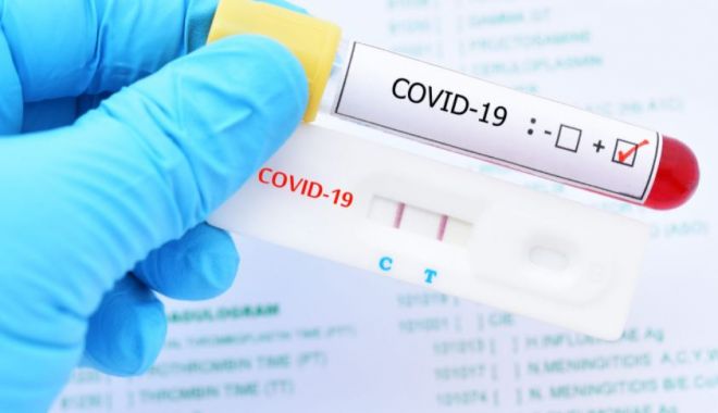 CORONAVIRUS / În ultimele 24 de ore au fost 73 de cazuri noi. Aproape 300 de decese COVID-19 raportate de autorități