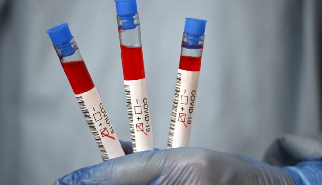 Aproape 50 de noi infectări cu Covid-19 în ultimele 24 de ore. Două persoane au murit după infectare