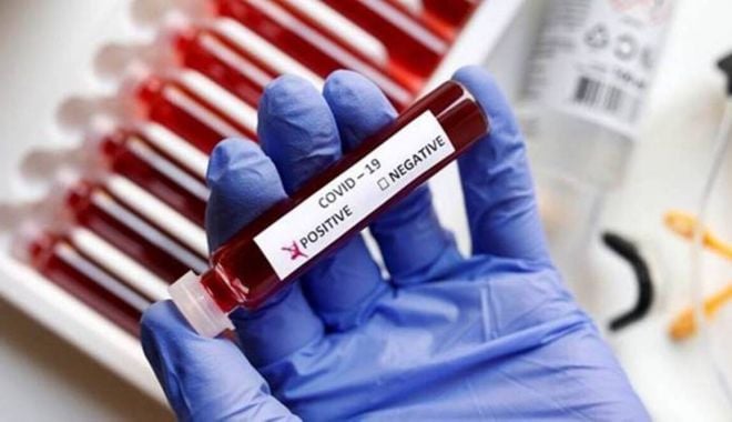 COVID-19. Uşoară creştere a numărul de cazuri zilnice, la Constanţa