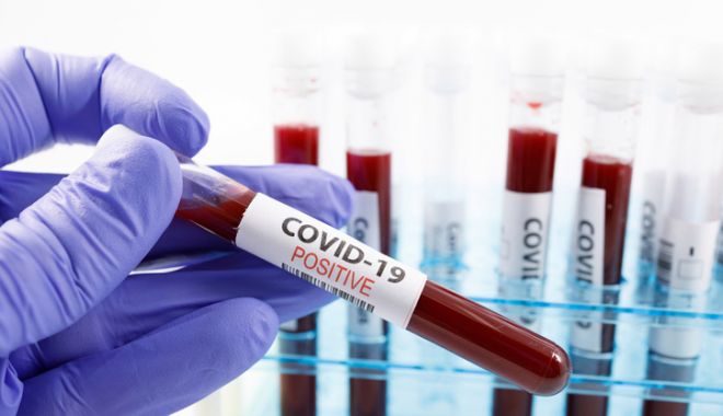 COVID-19. Incidenţa în continuă scădere, la Constanţa