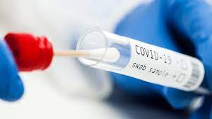 Teste gratuite anti-Covid în 120 de farmacii din România. Andrei Baciu: "Demersurile vor continua"