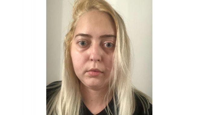 Șansă la viaţă! Apel umanitar pentru Diana, o tânără absolventă de Medicină, bolnavă de cancer