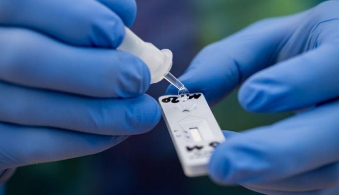 Testul PCR negativ nu exclude infecţia cu COVID-19, concluzia unui centru medical după peste 50.000 de teste