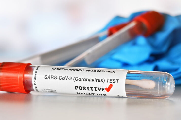 Coronavirus în România: Peste 10.000 de cazuri noi de infectare în 24 de ore - test-1642237415.jpg